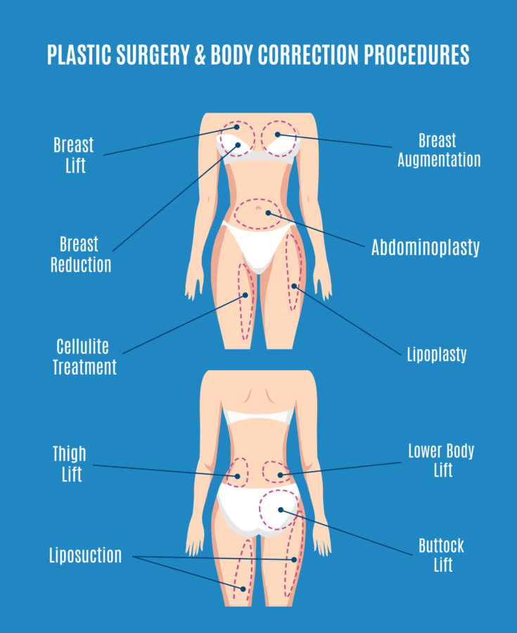 Plastic surgery and body correction vector illustration. Lifting plasty and liposuction, cellulite removal and fat lose. Torso and augmentation, abdominoplasty patient, beauty health