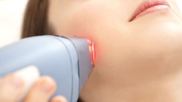 Hair Removal Laser