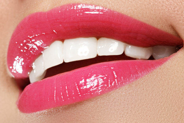 affordable teeth whitening