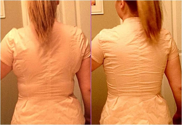 Use body contour tape to hide back fat