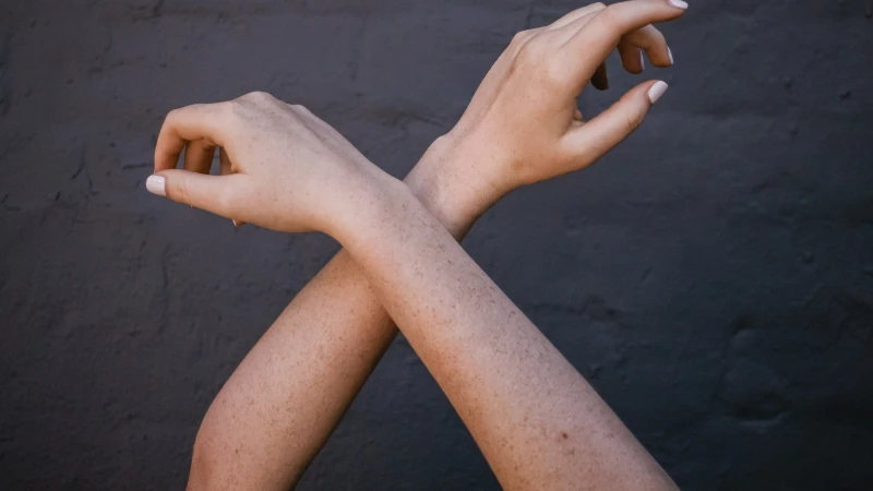 Laser Freckle Removal
